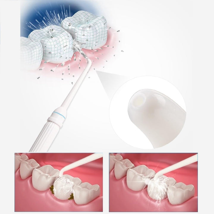 Dental Irrigator Angeschlossen an den Wasserhahn, ohne Batterien und Strom, Wasserpuls Zahnreiniger