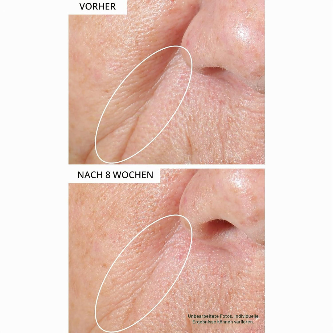 StriVectinTIGHTENING face serum 50 ml
