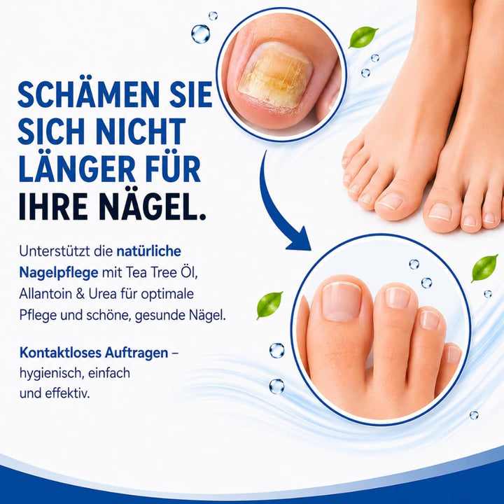 Kosmetische Nagelpilz Pflege – 100 ml Nagelöl - Schnell &amp; Intensiv – Wasserfreie Formel mit Teebaumö