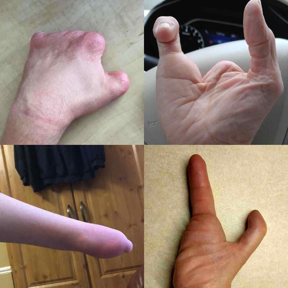 active hands Griffhilfe für Gliedmassen S Left, S Left