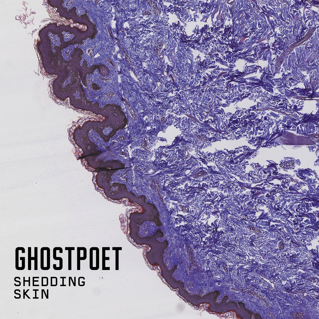Shedding Skin, Vinyl