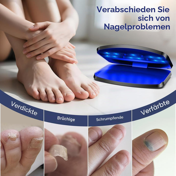 Upgrade Nagelpilz Lasergerät, 15 LED Tragbar &amp; Wiederaufladbar per USB-C, 11 Blaulicht + 4 Infrarot,