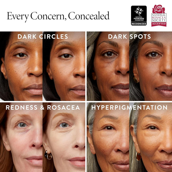 LAURA GELLER NEW YORK Ideal Fix Concealer für Hautunreinheiten und Augenringe, mittelgross, vollstän