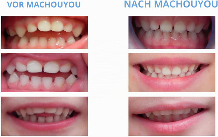Machouyou nach Schnuller